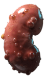 Kidney 1