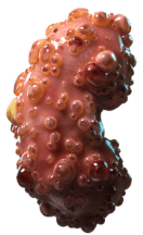 Kidney 2