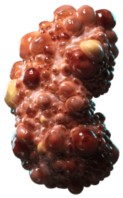 Kidney 3