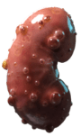 Kidney 1